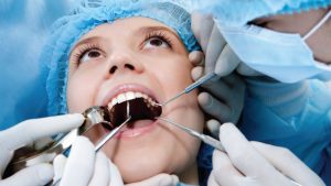 راه های از بین بردن دندان عقل دردناک
